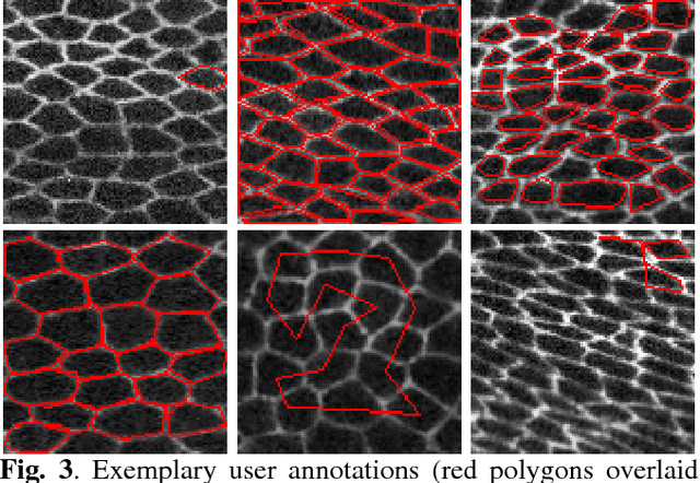 Figure 3 for Crowd Sourcing Image Segmentation with iaSTAPLE