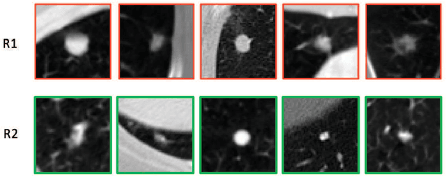 Figure 1 for An Interpretable Deep Hierarchical Semantic Convolutional Neural Network for Lung Nodule Malignancy Classification