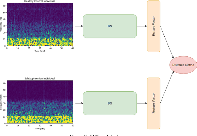 Figure 3 for On the use of Pairwise Distance Learning for Brain Signal Classification with Limited Observations