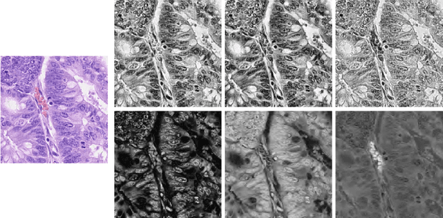 Figure 1 for Color Space-based HoVer-Net for Nuclei Instance Segmentation and Classification