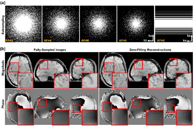 Figure 3 for Accelerating Quantitative Susceptibility Mapping using Compressed Sensing and Deep Neural Network