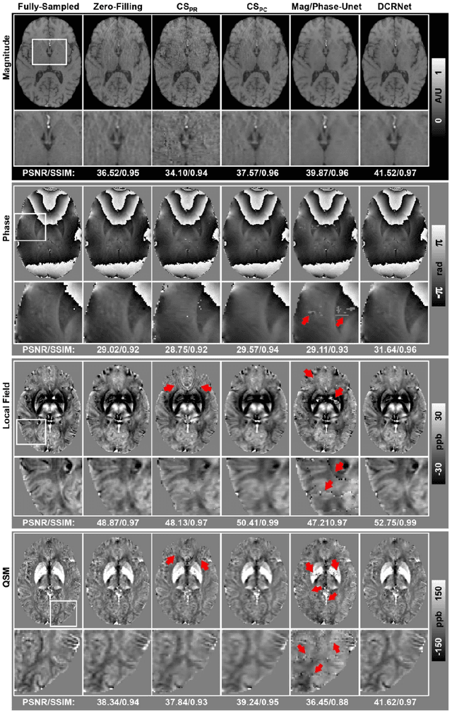Figure 4 for Accelerating Quantitative Susceptibility Mapping using Compressed Sensing and Deep Neural Network
