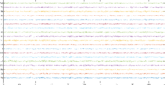 Figure 3 for Automatic Diagnosis of Schizophrenia using EEG Signals and CNN-LSTM Models