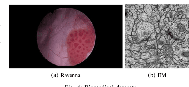 Figure 4 for Smart(Sampling)Augment: Optimal and Efficient Data Augmentation for Semantic Segmentation