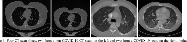Figure 2 for AI-MIA: COVID-19 Detection & Severity Analysis through Medical Imaging