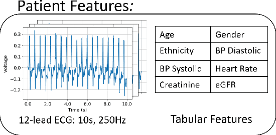 Figure 4 for Learning to Predict with Supporting Evidence: Applications to Clinical Risk Prediction