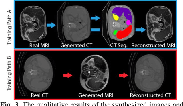 Figure 3 for Adversarial Synthesis Learning Enables Segmentation Without Target Modality Ground Truth