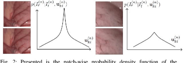 Figure 4 for BDIS: Bayesian Dense Inverse Searching Method for Real-Time Stereo Surgical Image Matching