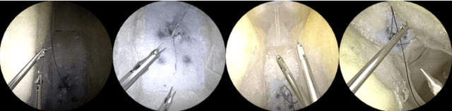 Figure 3 for MBAPose: Mask and Bounding-Box Aware Pose Estimation of Surgical Instruments with Photorealistic Domain Randomization