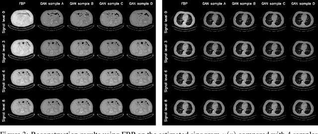 Figure 3 for Generative Tomography Reconstruction