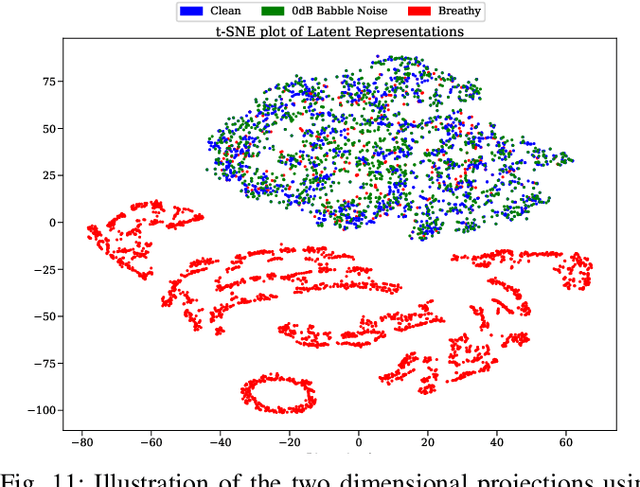 Figure 3 for Adversarial Approximate Inference for Speech to Electroglottograph Conversion