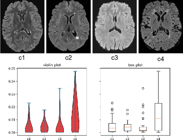 Figure 1 for MS Lesion Segmentation: Revisiting Weighting Mechanisms for Federated Learning