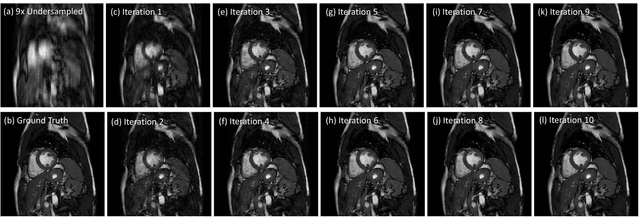 Figure 4 for Convolutional Recurrent Neural Networks for Dynamic MR Image Reconstruction