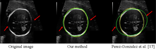 Figure 3 for Annotation-Efficient Learning for Medical Image Segmentation based on Noisy Pseudo Labels and Adversarial Learning