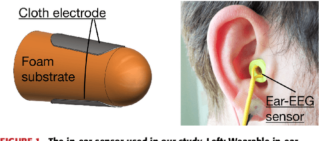 Figure 1 for Automatic sleep monitoring using ear-EEG