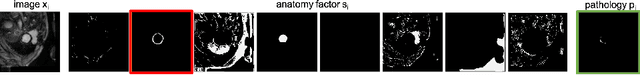 Figure 1 for Semi-supervised Pathology Segmentation with Disentangled Representations