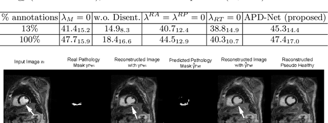 Figure 4 for Semi-supervised Pathology Segmentation with Disentangled Representations