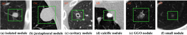 Figure 1 for Dual-branch residual network for lung nodule segmentation