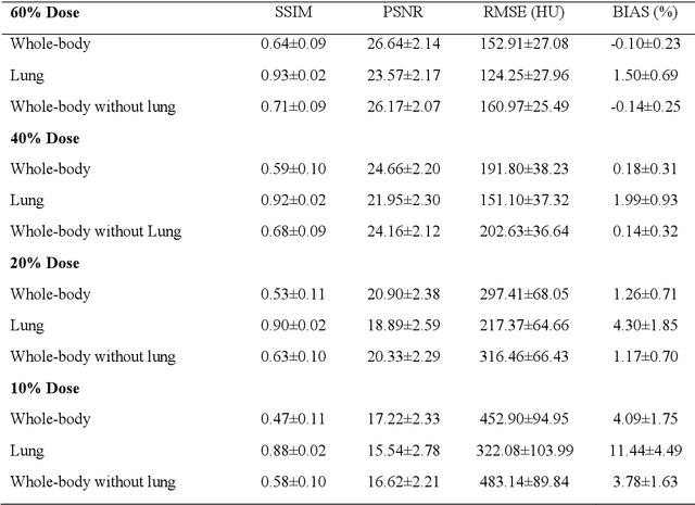 Figure 2 for Quantitative analysis of image quality in low-dose CT imaging for Covid-19 patients