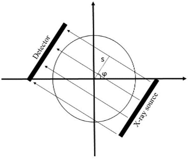 Figure 1 for Quantitative analysis of image quality in low-dose CT imaging for Covid-19 patients