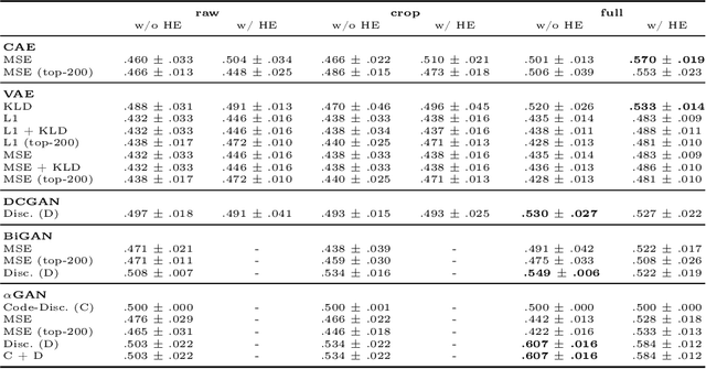 Figure 2 for Unsupervised Anomaly Detection for X-Ray Images