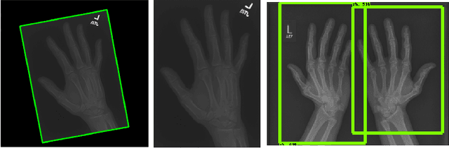 Figure 4 for Unsupervised Anomaly Detection for X-Ray Images