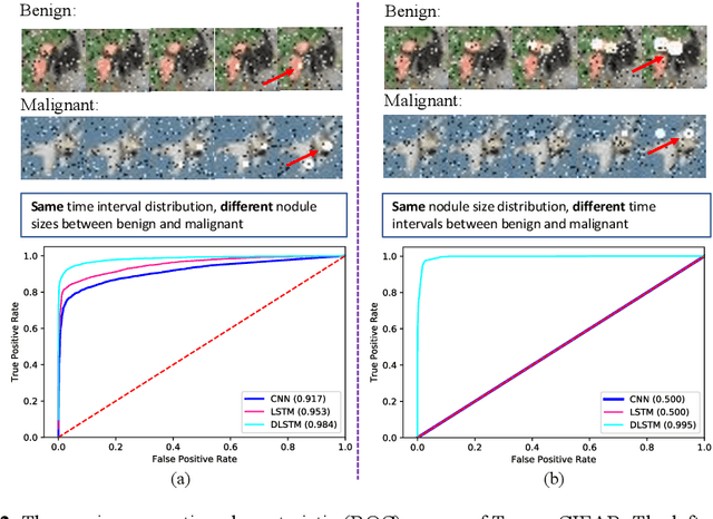 Figure 3 for Distanced LSTM: Time-Distanced Gates in Long Short-Term Memory Models for Lung Cancer Detection