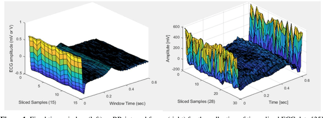 Figure 1 for Deep Learning-Based Arrhythmia Detection Using RR-Interval Framed Electrocardiograms