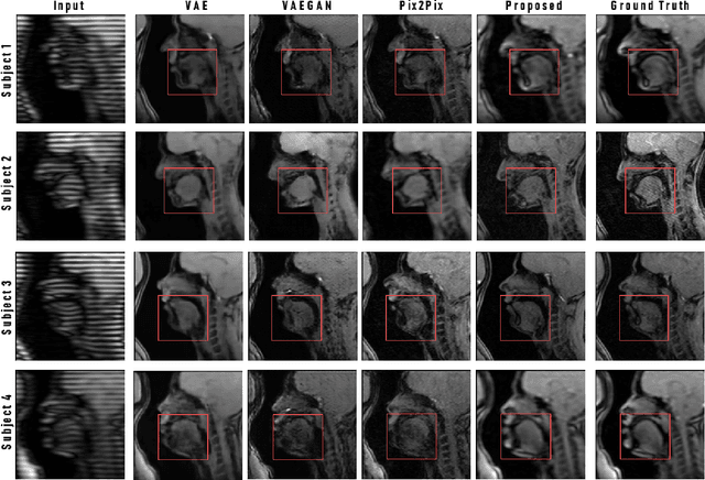 Figure 3 for Dual-cycle Constrained Bijective VAE-GAN For Tagged-to-Cine Magnetic Resonance Image Synthesis