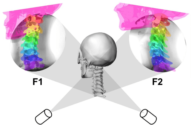 Figure 1 for Transfer Learning from an Artificial Radiograph-landmark Dataset for Registration of the Anatomic Skull Model to Dual Fluoroscopic X-ray Images