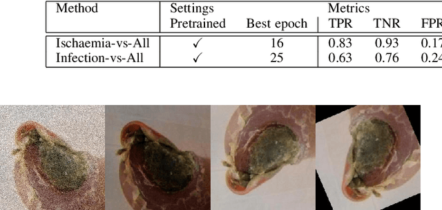 Figure 3 for Analysis Towards Classification of Infection and Ischaemia of Diabetic Foot Ulcers
