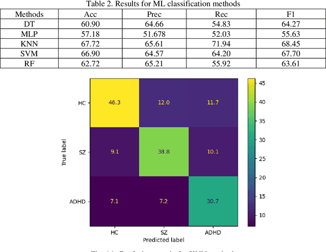 Figure 4 for Automatic Diagnosis of Schizophrenia and Attention Deficit Hyperactivity Disorder in rs-fMRI Modality using Convolutional Autoencoder Model and Interval Type-2 Fuzzy Regression