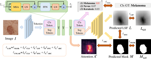 Figure 1 for MT-TransUNet: Mediating Multi-Task Tokens in Transformers for Skin Lesion Segmentation and Classification