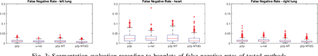 Figure 3 for Image to Images Translation for Multi-Task Organ Segmentation and Bone Suppression in Chest X-Ray Radiography