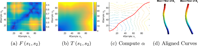 Figure 1 for Fiber-Flux Diffusion Density for White Matter Tracts Analysis: Application to Mild Anomalies Localization in Contact Sports Players