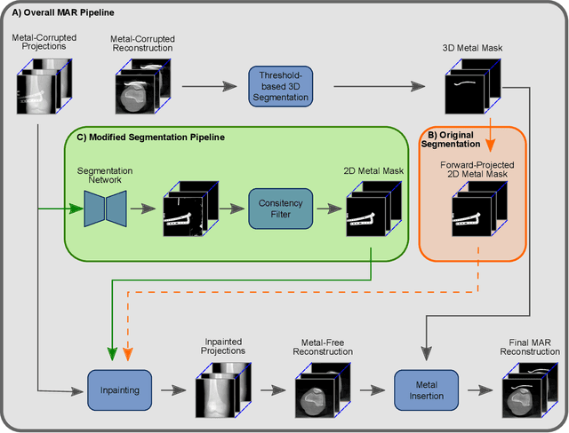 Figure 1 for View-Consistent Metal Segmentation in the Projection Domain for Metal Artifact Reduction in CBCT -- An Investigation of Potential Improvement