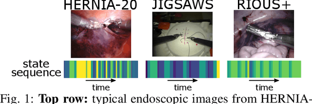Figure 1 for Learning Invariant Representation of Tasks for Robust Surgical State Estimation