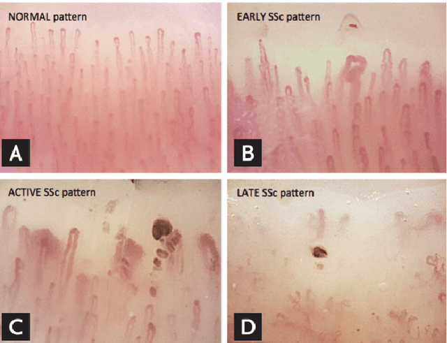 Figure 1 for Deep Learning and Computer Vision Techniques for Microcirculation Analysis: A Review