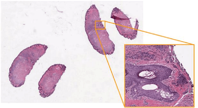 Figure 2 for Prediction of Kidney Function from Biopsy Images Using Convolutional Neural Networks