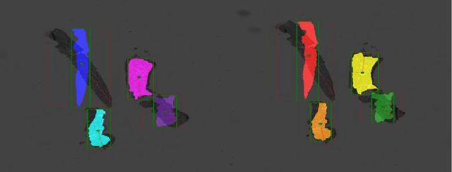 Figure 3 for Prediction of Kidney Function from Biopsy Images Using Convolutional Neural Networks