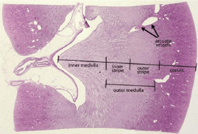 Figure 4 for Prediction of Kidney Function from Biopsy Images Using Convolutional Neural Networks