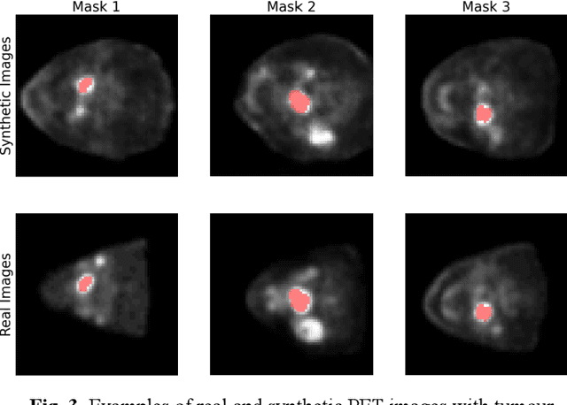 Figure 3 for Assessing Privacy Leakage in Synthetic 3-D PET Imaging using Transversal GAN