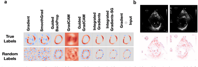 Figure 4 for Medical Imaging and Machine Learning