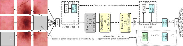 Figure 2 for Skin Lesion Classification Using CNNs with Patch-Based Attention and Diagnosis-Guided Loss Weighting