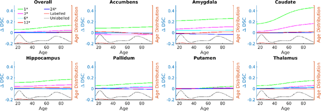 Figure 4 for GANsfer Learning: Combining labelled and unlabelled data for GAN based data augmentation