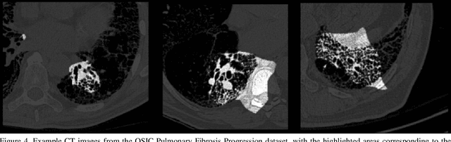 Figure 4 for Insights into Data through Model Behaviour: An Explainability-driven Strategy for Data Auditing for Responsible Computer Vision Applications