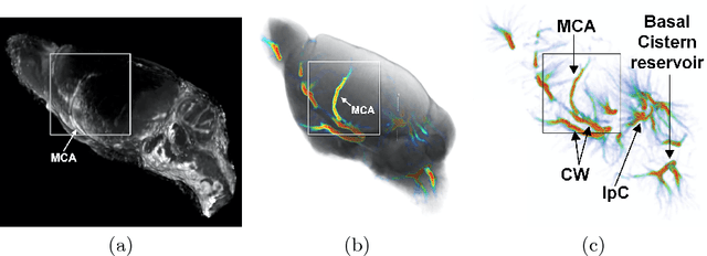 Figure 4 for GlymphVIS: Visualizing Glymphatic Transport Pathways Using Regularized Optimal Transport