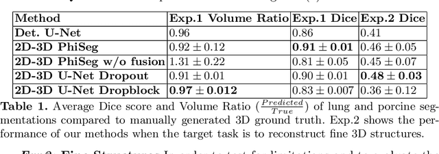 Figure 2 for 3D Probabilistic Segmentation and Volumetry from 2D projection images