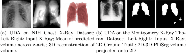 Figure 4 for 3D Probabilistic Segmentation and Volumetry from 2D projection images