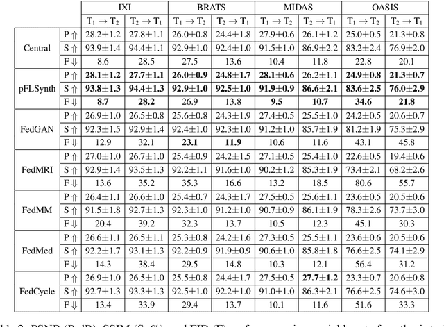 Figure 4 for One Model to Unite Them All: Personalized Federated Learning of Multi-Contrast MRI Synthesis